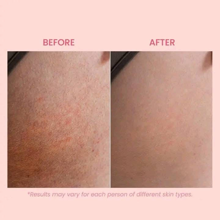 Luxe Organix Bum Bumps Booty Cream | Booty Scrub 285g