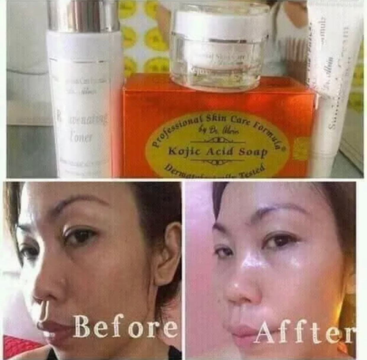 The Original Rejuvenating Set (New Box) - La Belleza AU Skin & Wellness