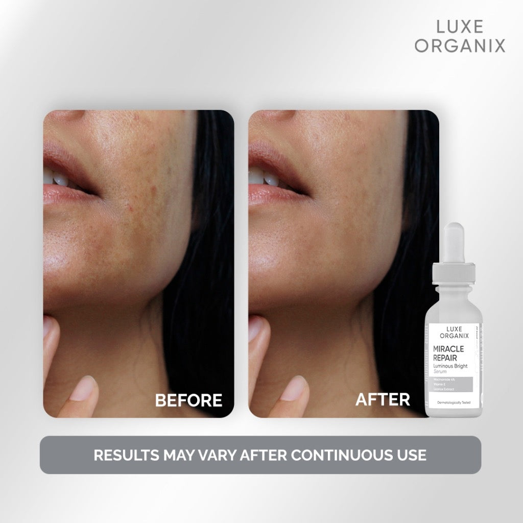 Miracle Repair Serum Niacinamide 4% 30ml