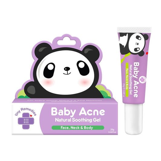 Baby Acne Soothing Gel 20g