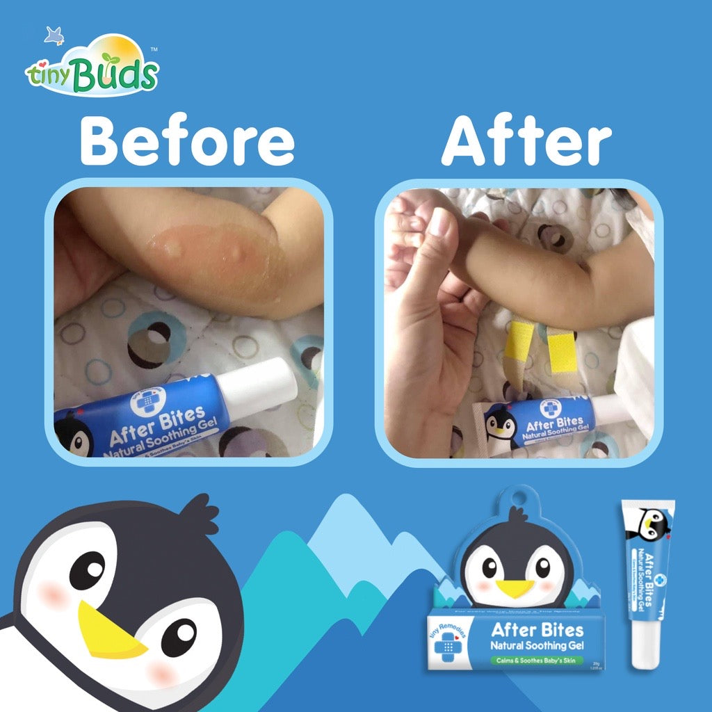 After Bites Natural Soothing Gel 20g
