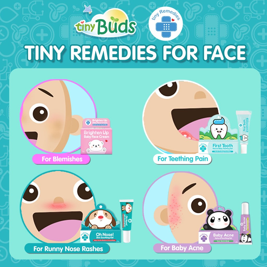 Tiny Buds Baby Acne Soothing Gel 20g