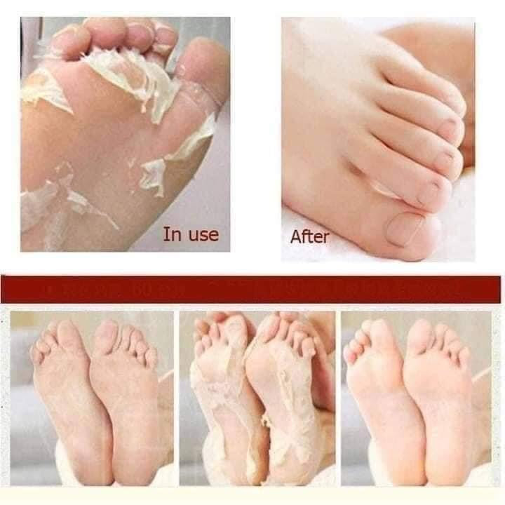 Brilliant Skin Heel & Toe Foot Mask (1 Pair) - La Belleza AU Skin & Wellness