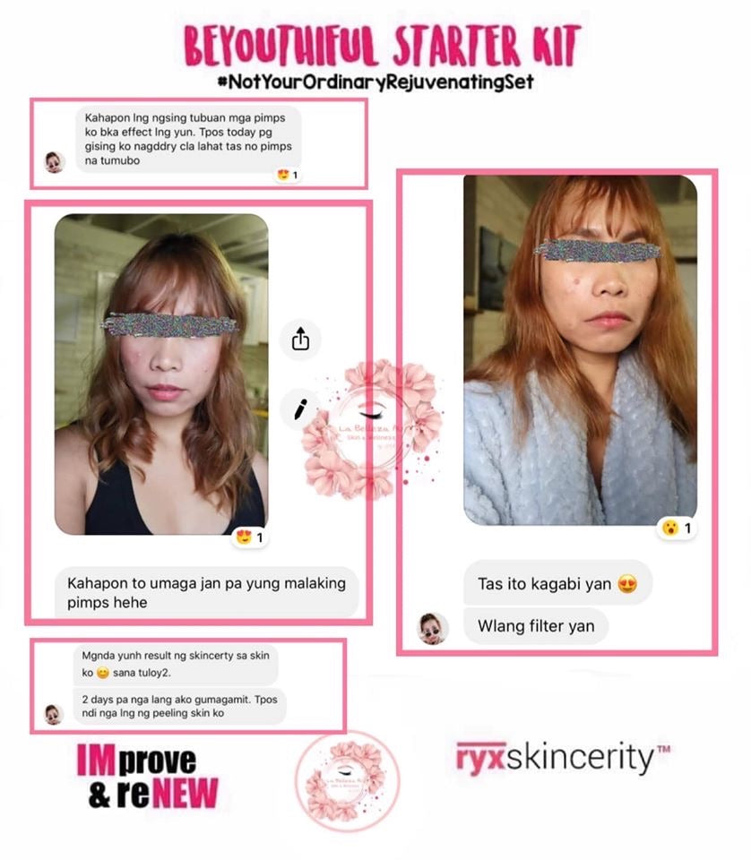 Beyouthiful Starter Kit 3.0 (With Sticker - Old Formula) - La Belleza AU Skin & Wellness