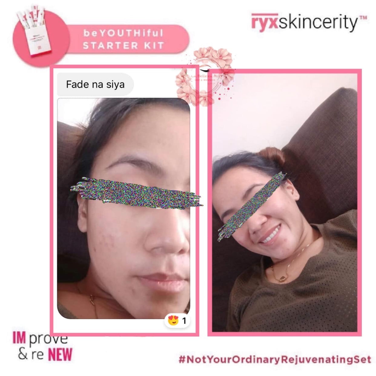 Beyouthiful Starter Kit 3.0 (With Sticker - Old Formula) - La Belleza AU Skin & Wellness