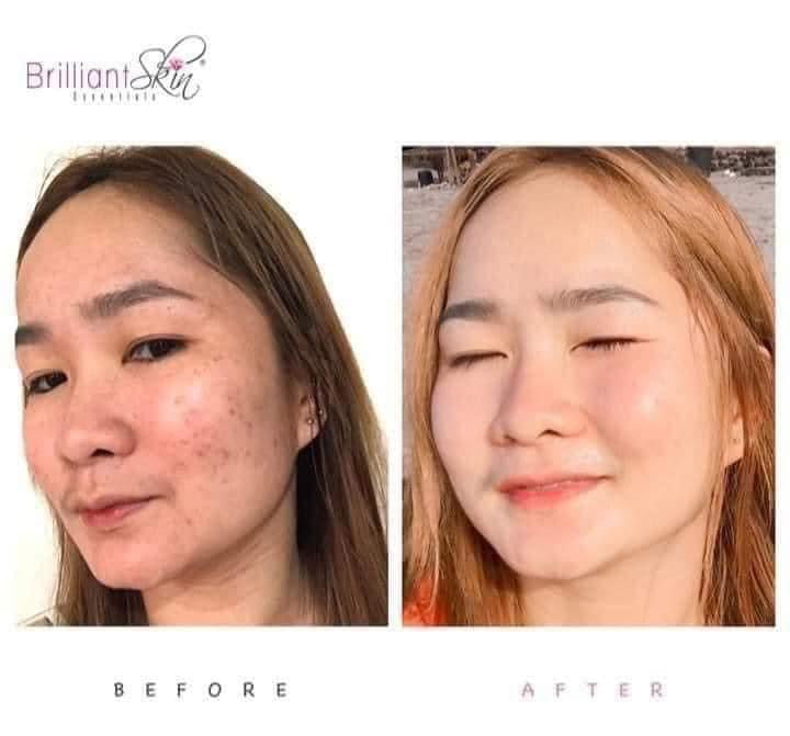 Brilliant Skin Whitening Facial Set (New Packaging) - La Belleza AU Skin & Wellness