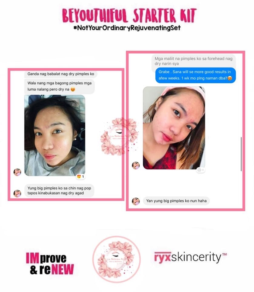 Beyouthiful Starter Kit 3.0 (With Sticker - Old Formula) - La Belleza AU Skin & Wellness