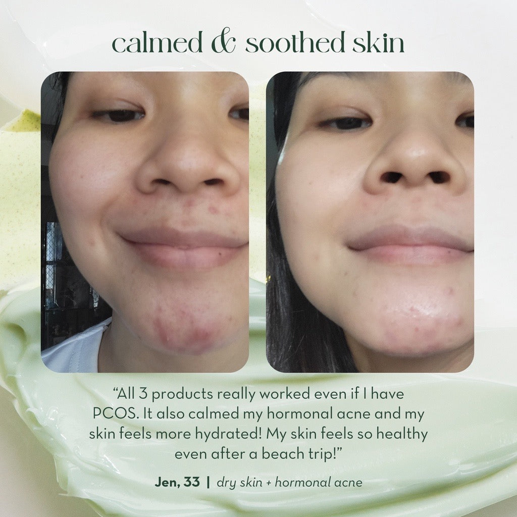 Happy Skin Calm & Soothe Skincare Boosters Full Set (Spot Corrector + Glow Drops + Overnight Cream) - La Belleza AU Skin & Wellness