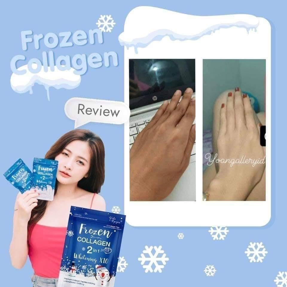 Frozen Collagen, Detox & Lazel Gluta Pure - La Belleza AU Skin & Wellness