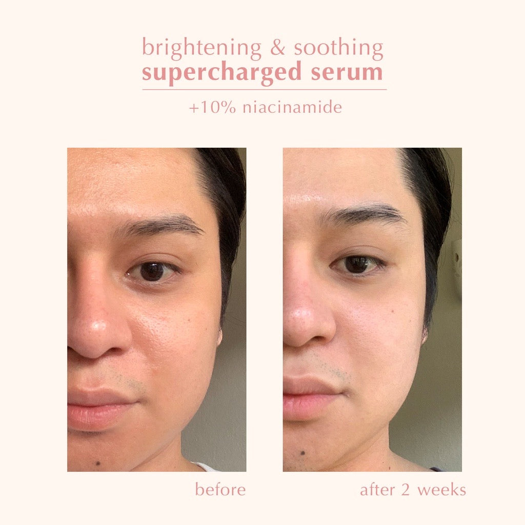 blk skin Brightening & Soothing Supercharged Serum +Niacinamide - La Belleza AU Skin & Wellness
