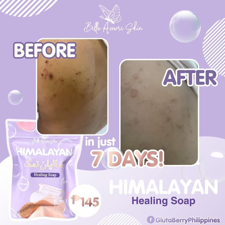Himalayan Healing Soap by Bella Amore Skin 130g - La Belleza AU Skin & Wellness