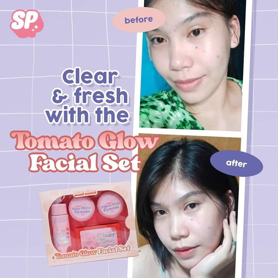 SkinPotions Tomato Glow Facial Set - Brightening & Anti-Acne Set - La Belleza AU Skin & Wellness