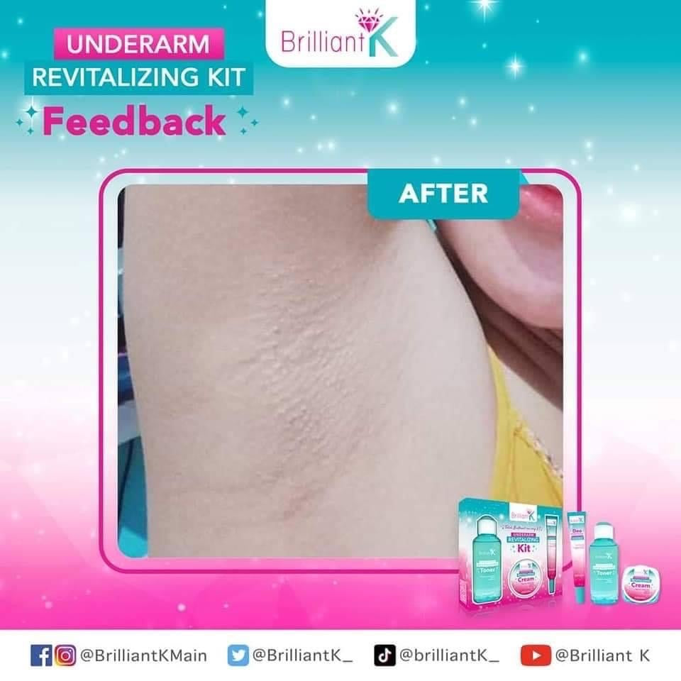 Brilliant Skin Underarm Revitalizing Kit - La Belleza AU Skin & Wellness