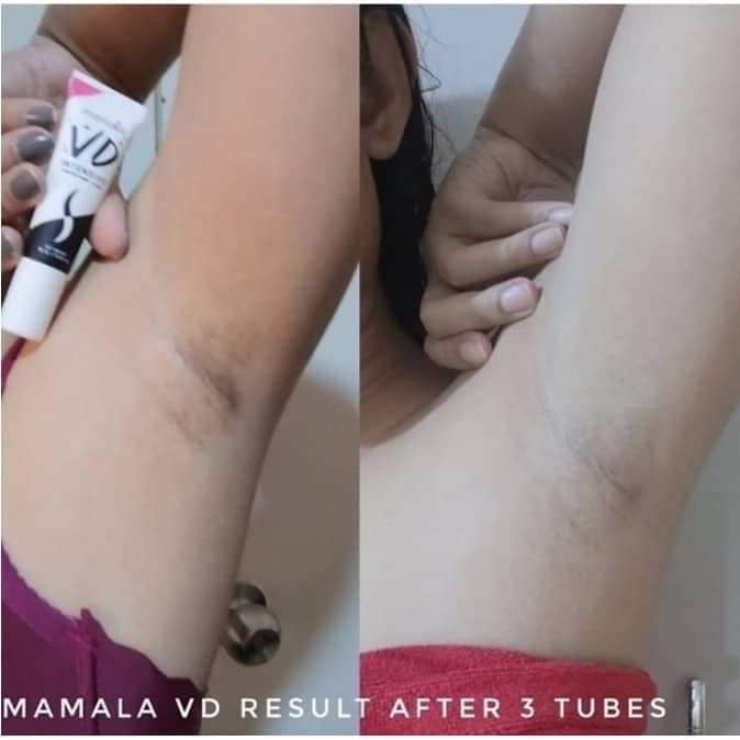 Mamala VD Intensive Underarm Care 10ml - La Belleza AU Skin & Wellness