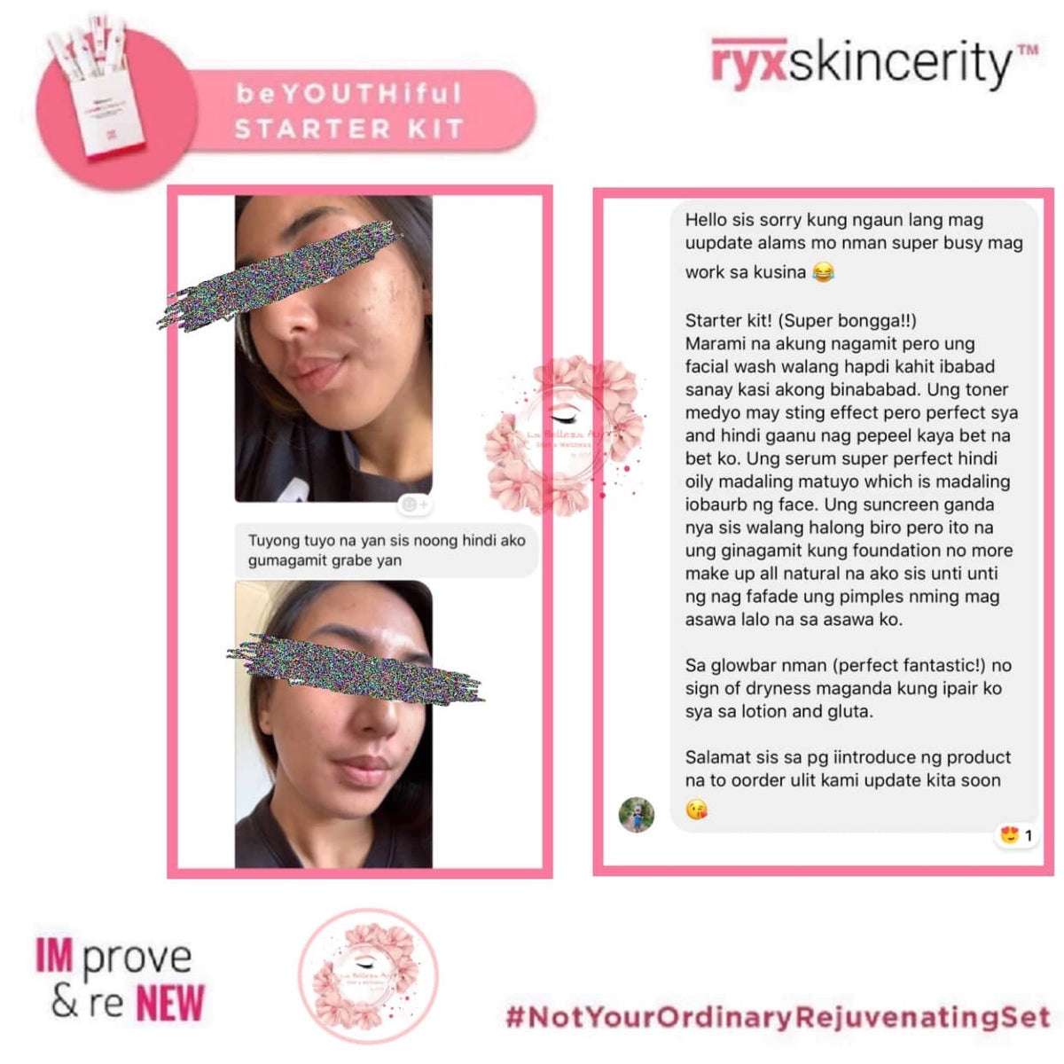 Beyouthiful Starter Kit 3.0 (With Sticker - Old Formula) - La Belleza AU Skin & Wellness