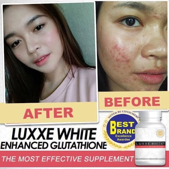 Luxxe White Enhanced Glutathione 60 capsules - La Belleza AU Skin & Wellness