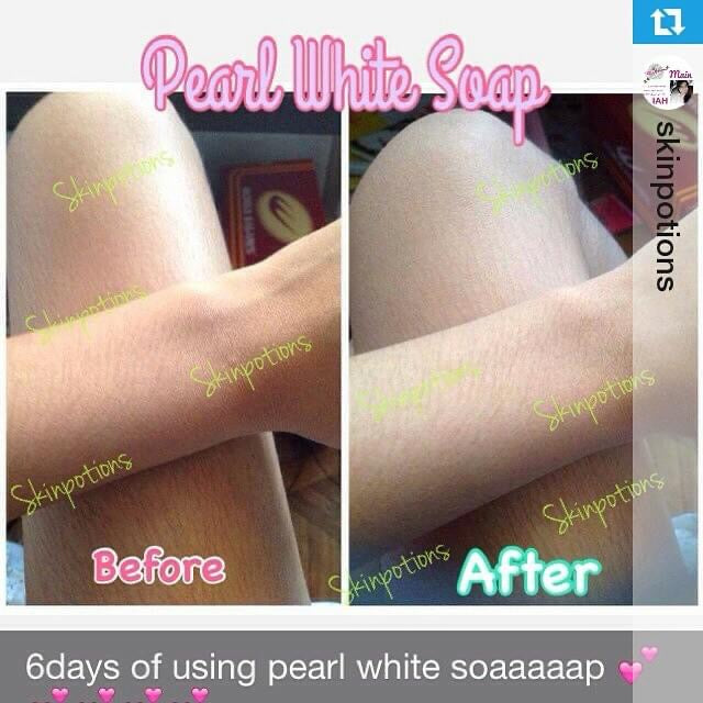 SkinPotions Pearl White Soap - Anti-Acne Whitening Soap 140g - La Belleza AU Skin & Wellness