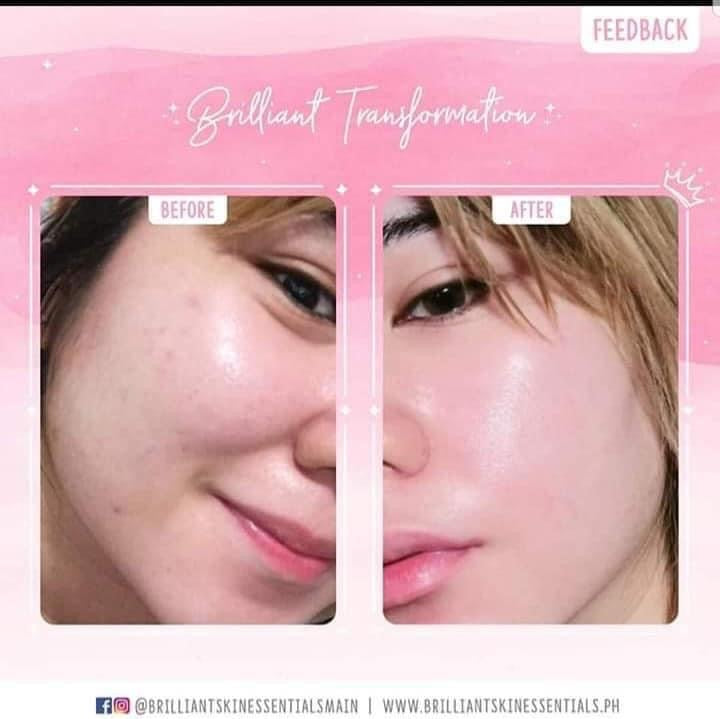 Brilliant Skin Whitening Facial Set (New Packaging) - La Belleza AU Skin & Wellness