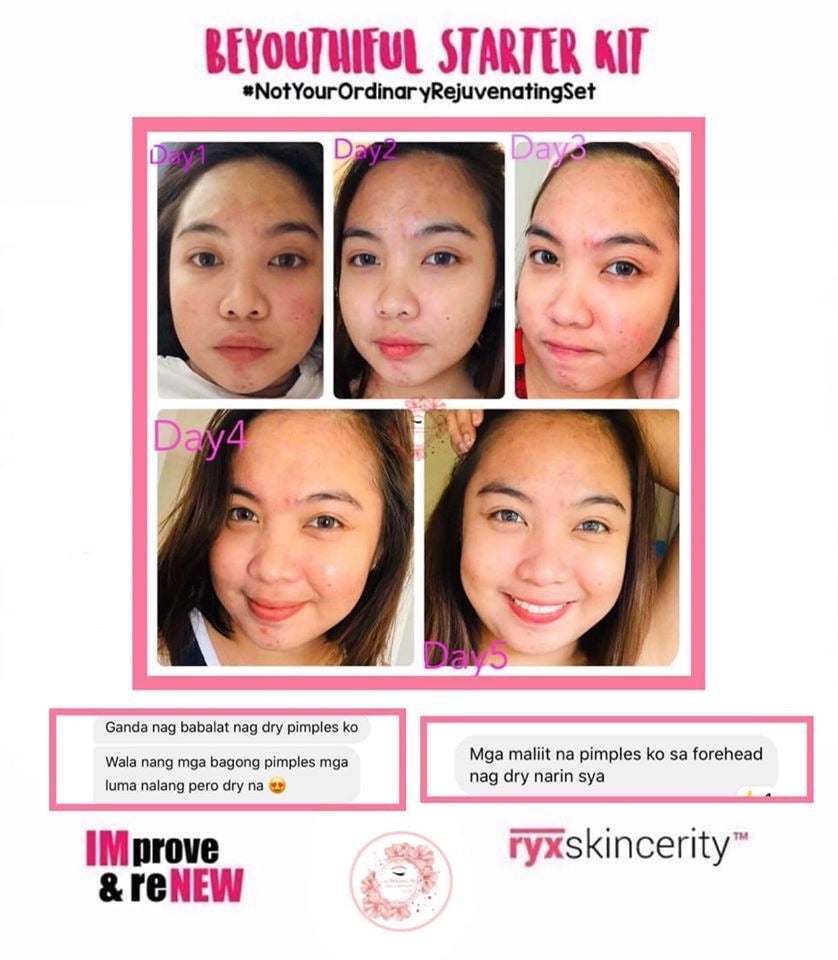 Beyouthiful Starter Kit 3.0 (With Sticker - Old Formula) - La Belleza AU Skin & Wellness