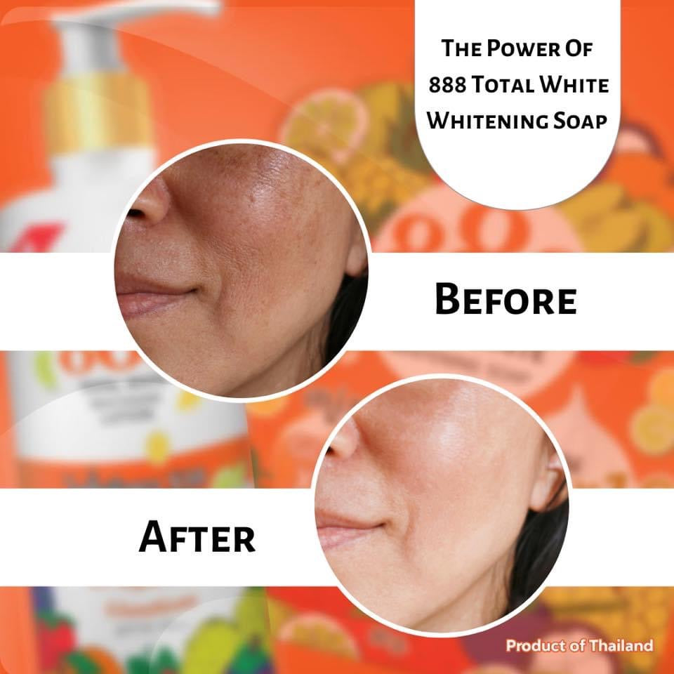 Total White Whitening Soap  Gluta x10  80g - La Belleza AU Skin & Wellness