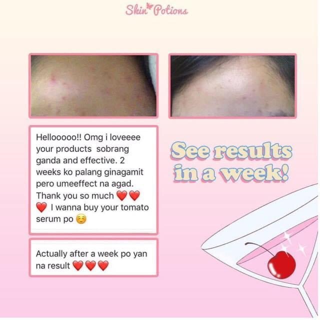SkinPotions Tomato Serum Pump 30ml - La Belleza AU Skin & Wellness