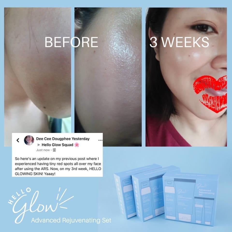 Hello Glow Advanced Rejuvenating Set - La Belleza AU Skin & Wellness