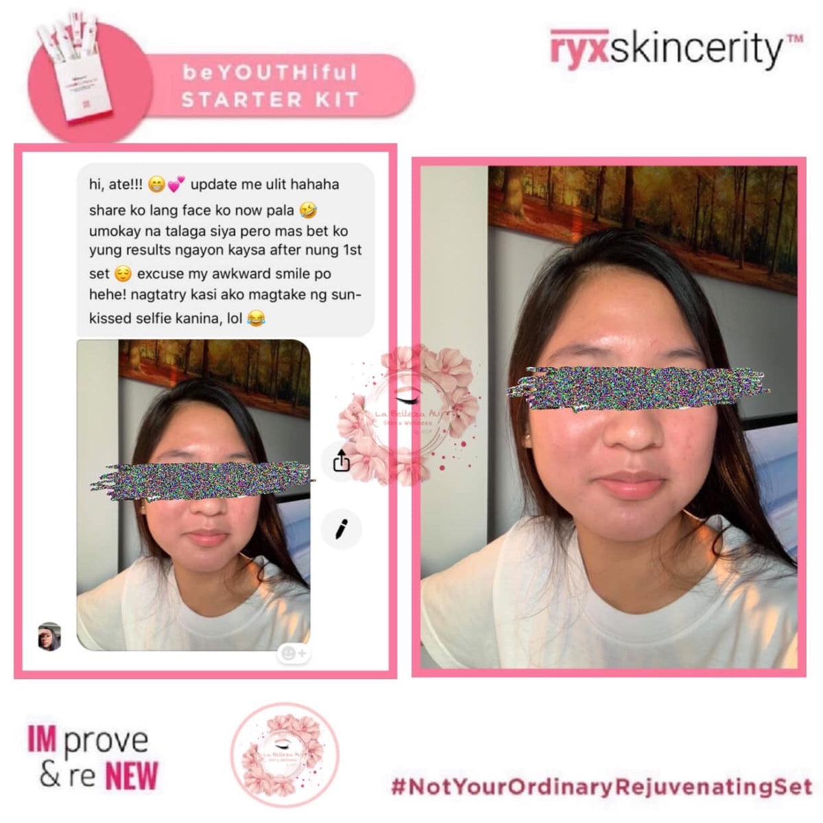 Beyouthiful Starter Kit 3.0 (With Sticker - Old Formula) - La Belleza AU Skin & Wellness