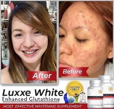 Luxxe White Enhanced Glutathione 60 capsules - La Belleza AU Skin & Wellness