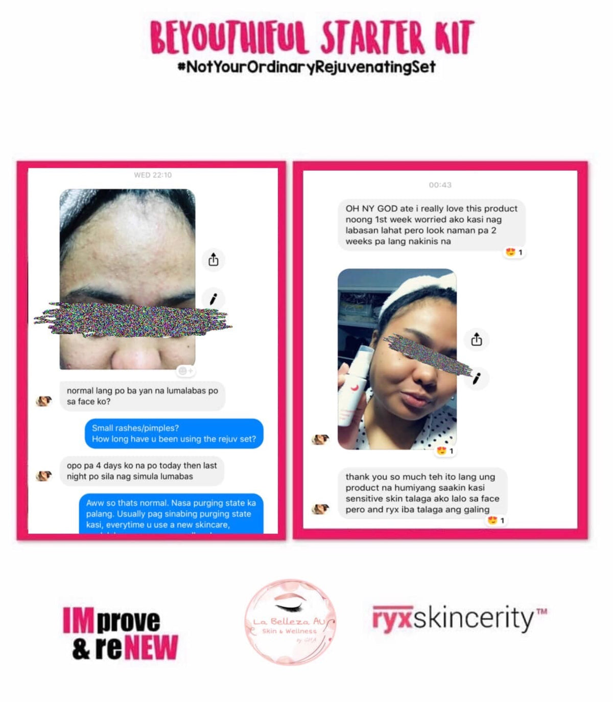 Beyouthiful Starter Kit 3.0 (With Sticker - Old Formula) - La Belleza AU Skin & Wellness